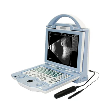 10,4-дюймовый ЖК-экран с высоким разрешением, Офтальмологический ультразвуковой аппарат A /B сканирования, УЗИ глаз для офтальмолога