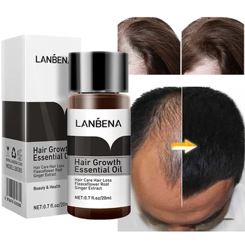 Эфирное масло для роста волос, Восстанавливающий уход за кожей головы, питательный, против выпадения волос, растительные ингредиенты для быстрого эффективного роста, Уход за волосами 20 мл